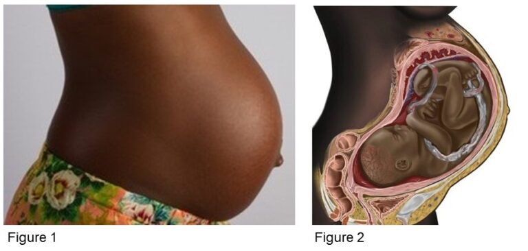 Pregnancy
