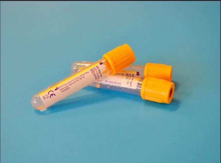 DNA testing